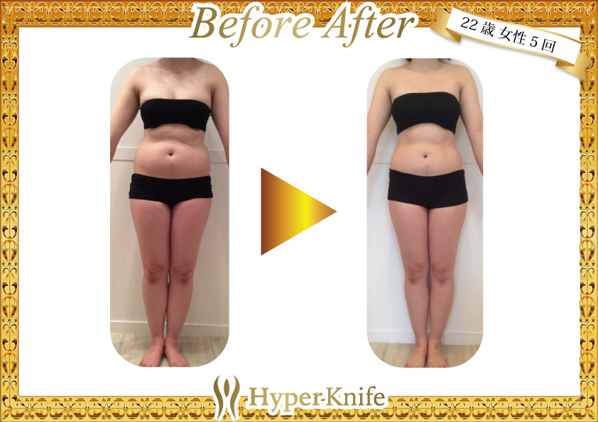 ビフォーアフター写真