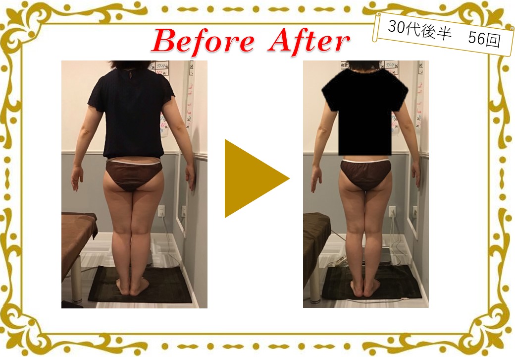 ビフォーアフター写真