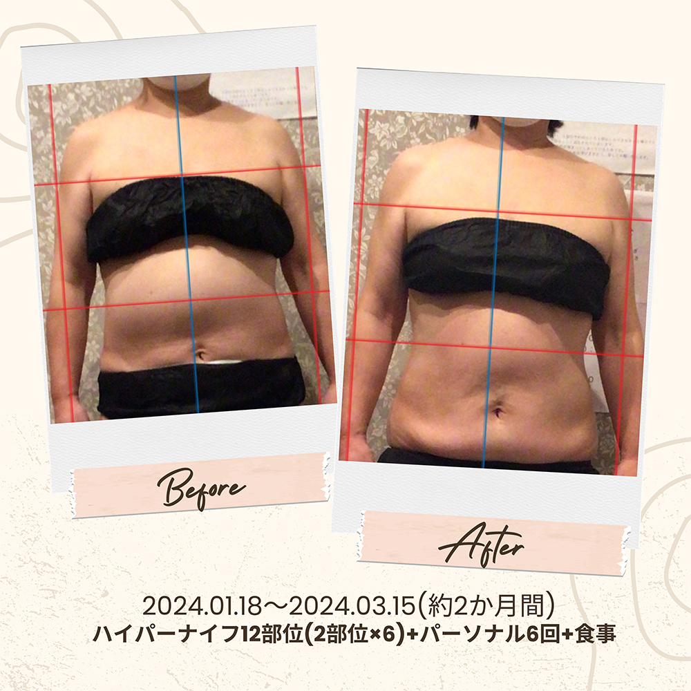 ビフォーアフター写真