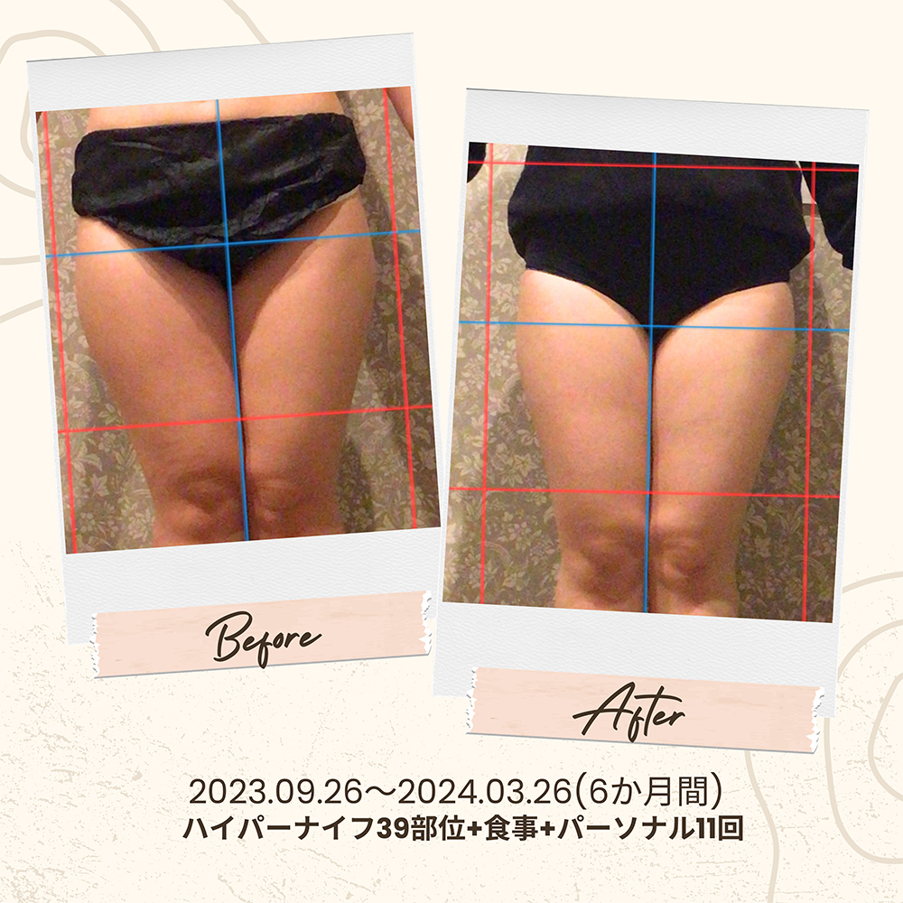 ビフォーアフター写真