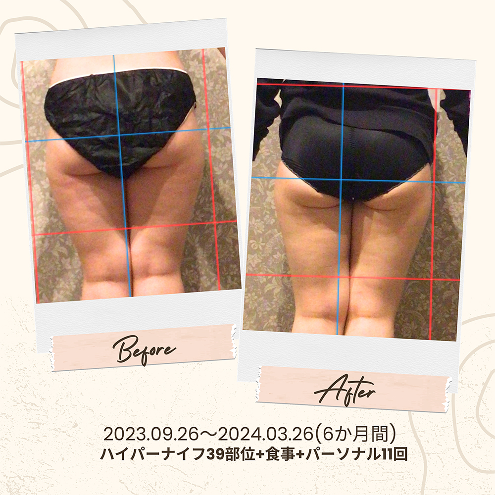 ビフォーアフター写真