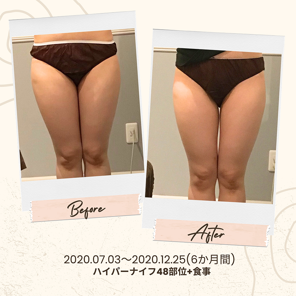 ビフォーアフター写真