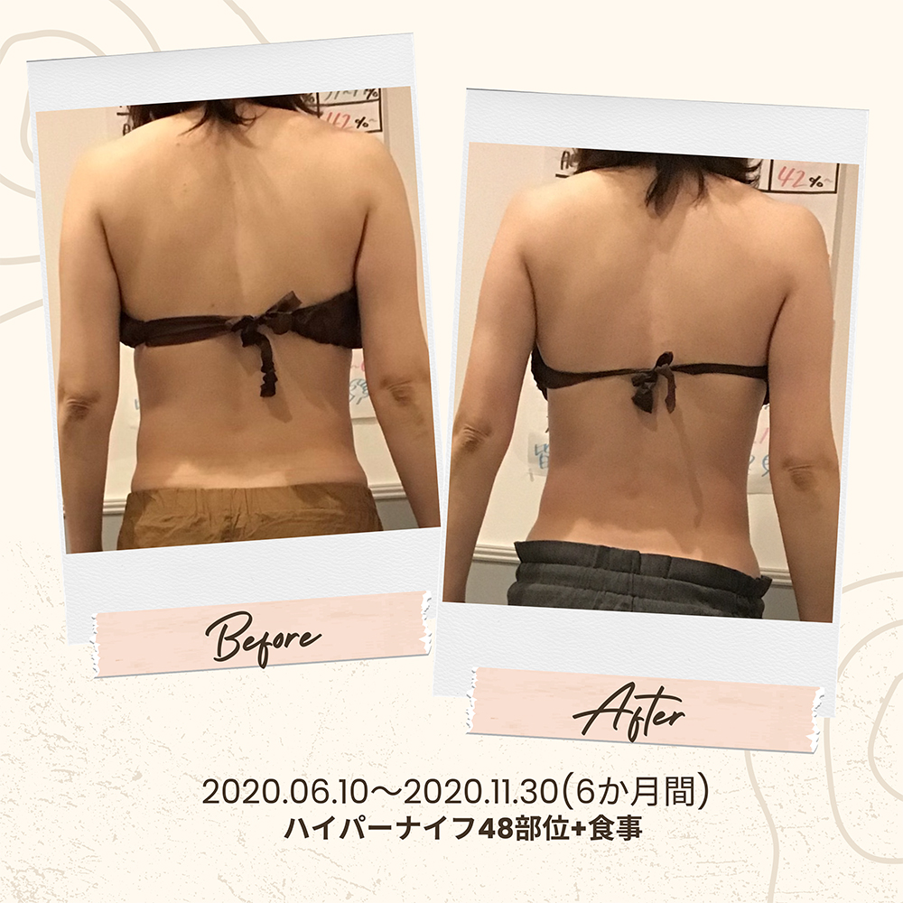 ビフォーアフター写真