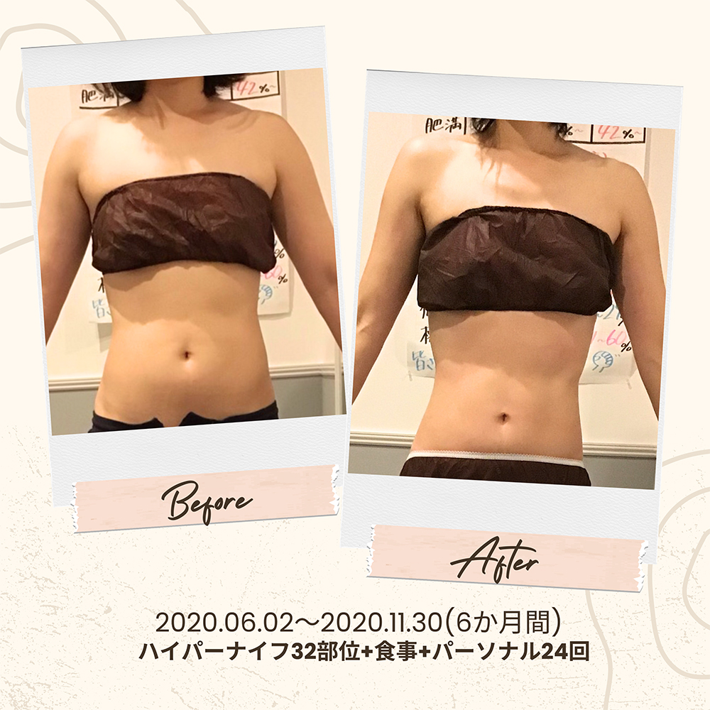 ビフォーアフター写真