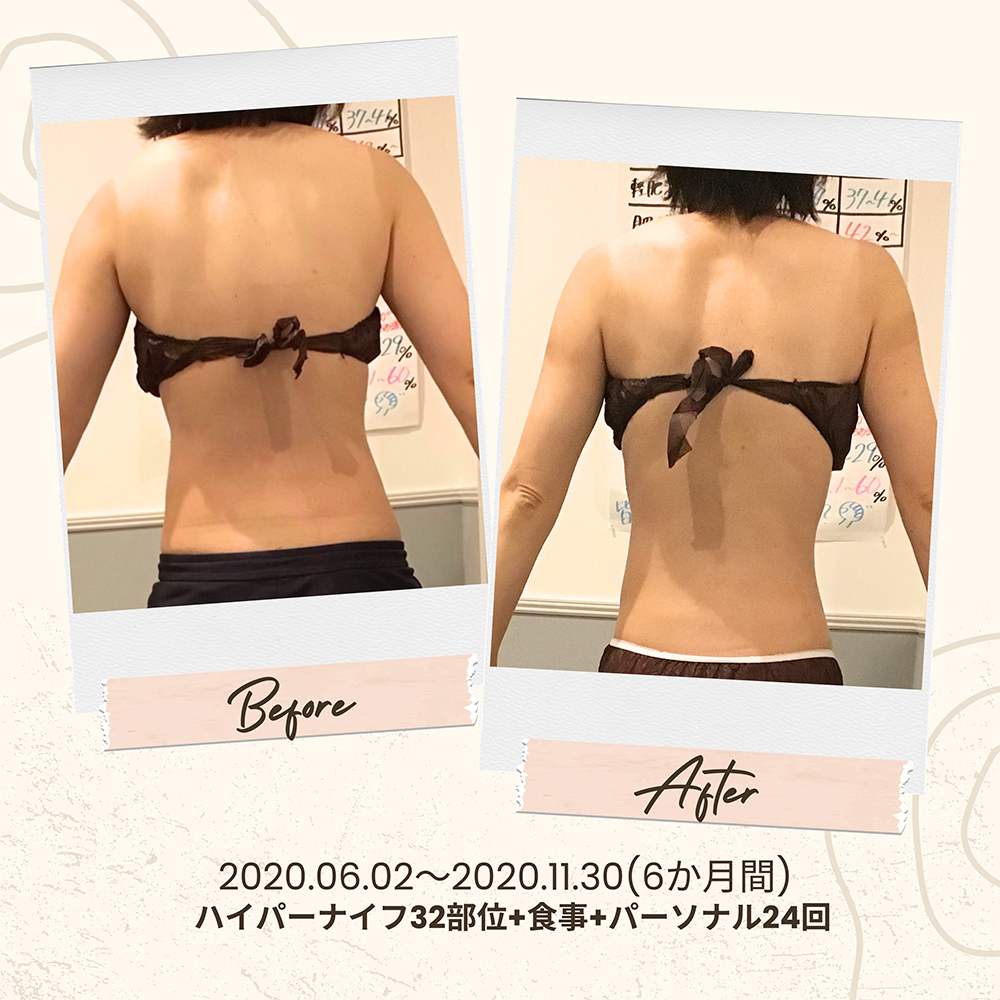 ビフォーアフター写真