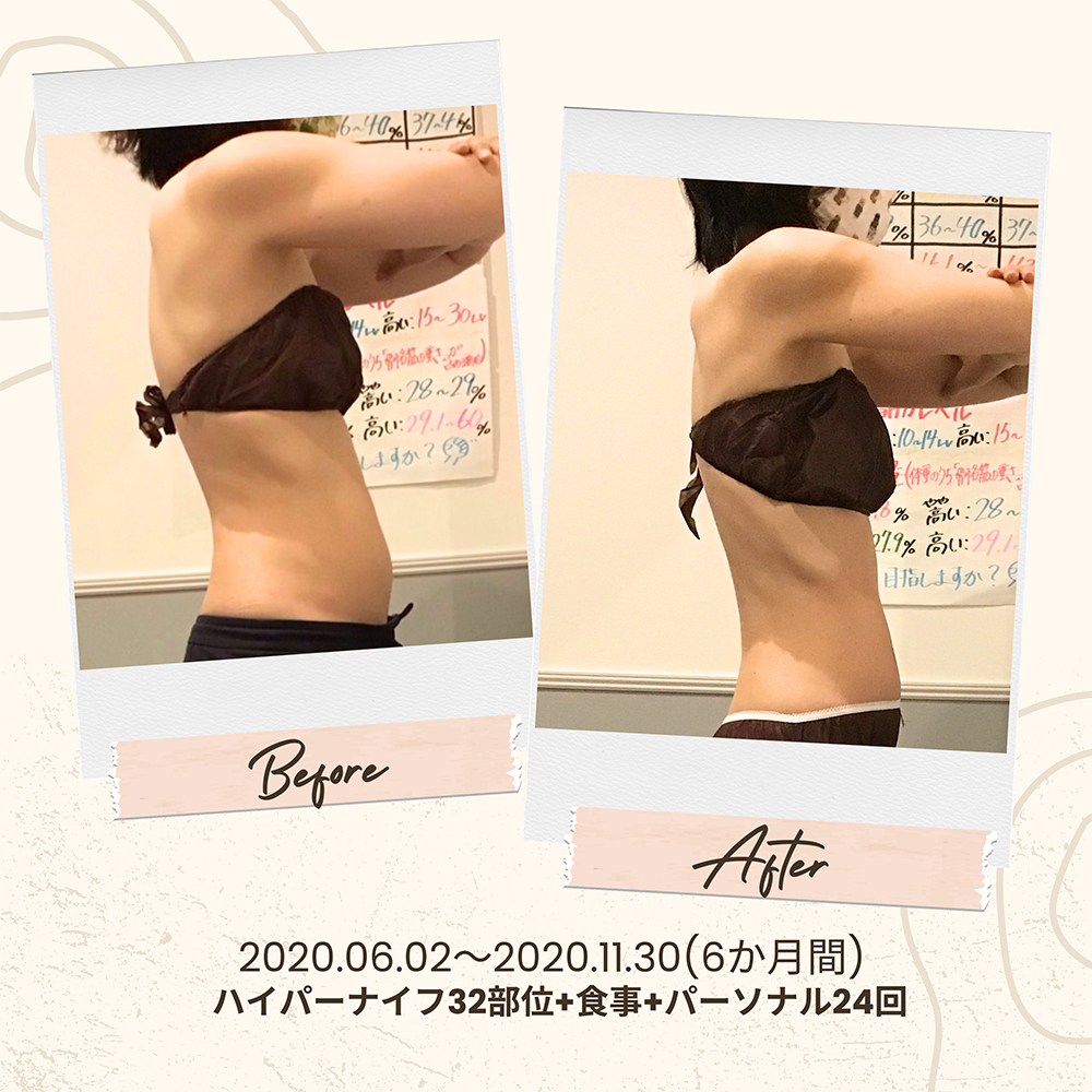 ビフォーアフター写真