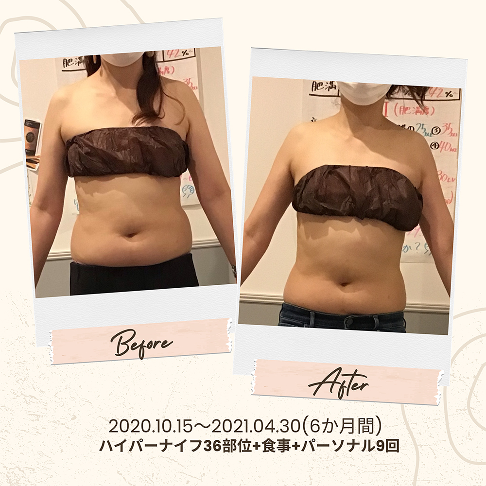 ビフォーアフター写真