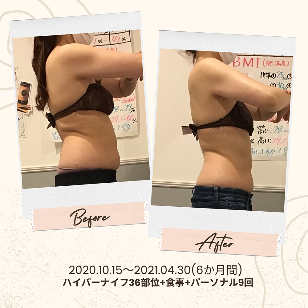 ビフォーアフター写真