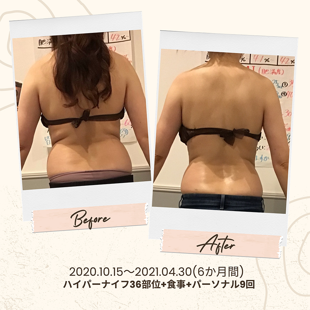 ビフォーアフター写真