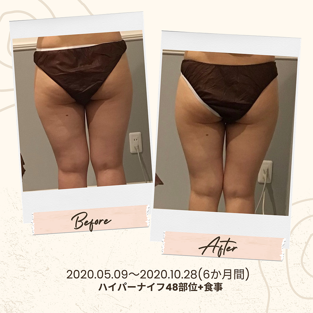 ビフォーアフター写真